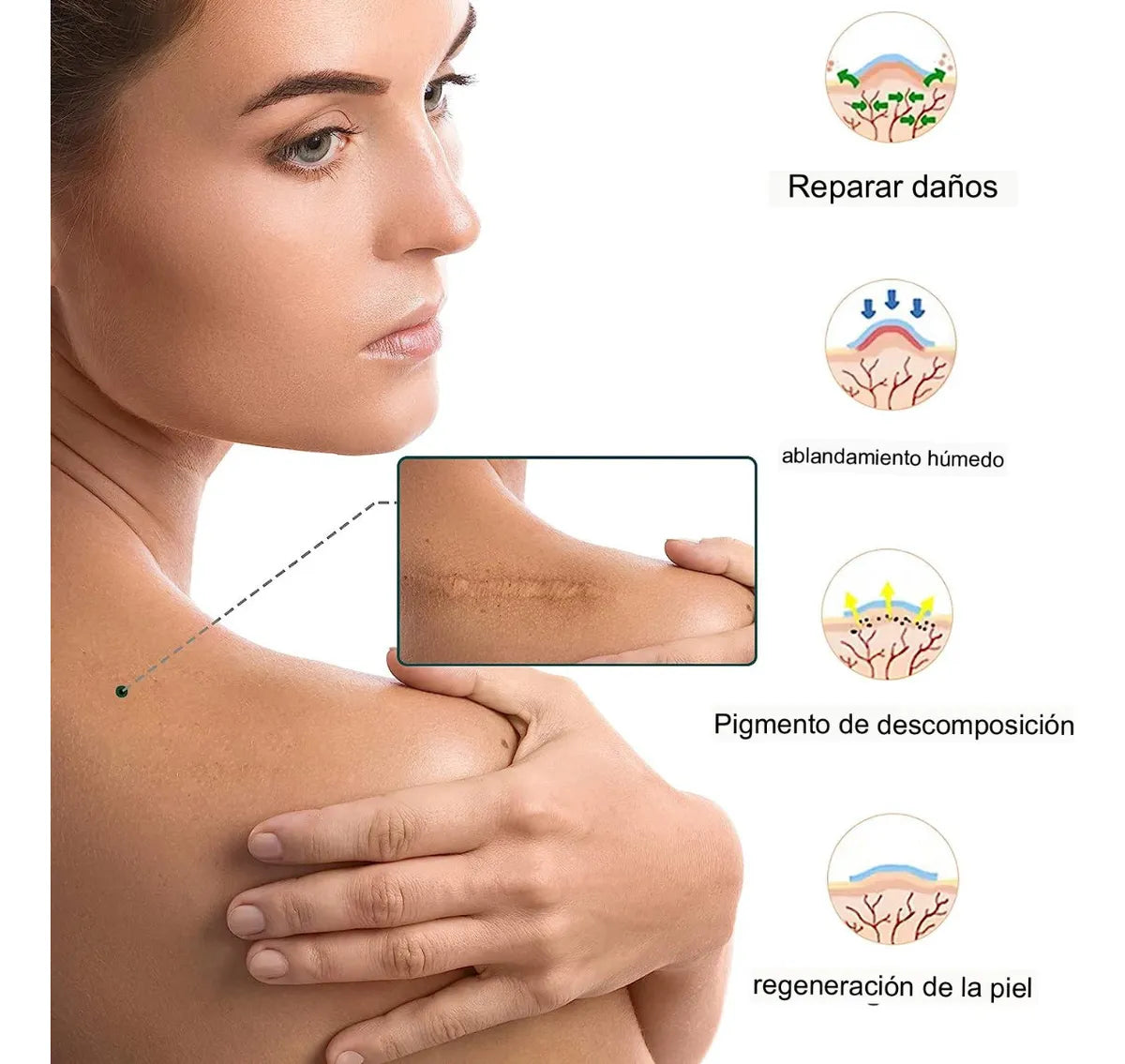 DermaSil™ - Cinta de silicona | Elimina las cicatrices y arrugas en semanas