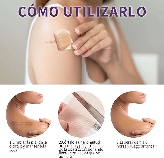 DermaSil™ - Cinta de silicona | Elimina las cicatrices y arrugas en semanas