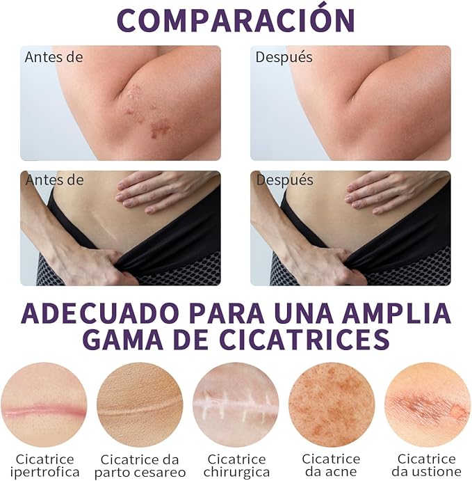 DermaSil™ - Cinta de silicona | Elimina las cicatrices y arrugas en semanas