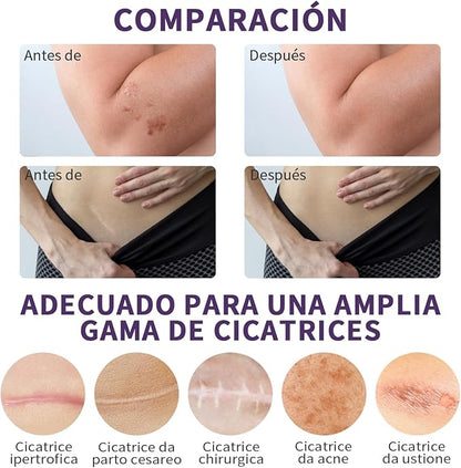 DermaSil™ - Cinta de silicona | Elimina las cicatrices y arrugas en semanas