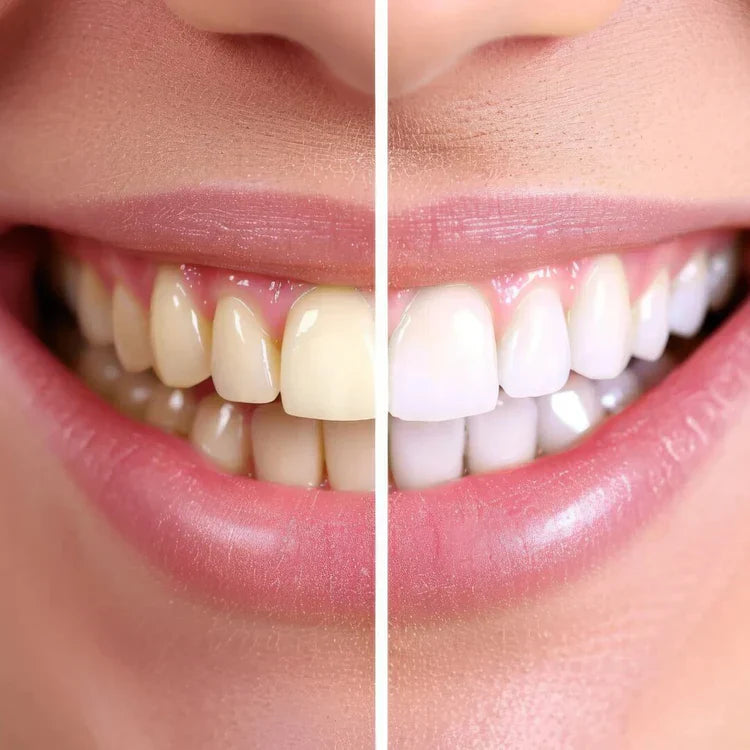 LumiClean UV™ - Cepillo dental ultrasónico