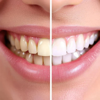 LumiClean UV™ - Cepillo dental ultrasónico